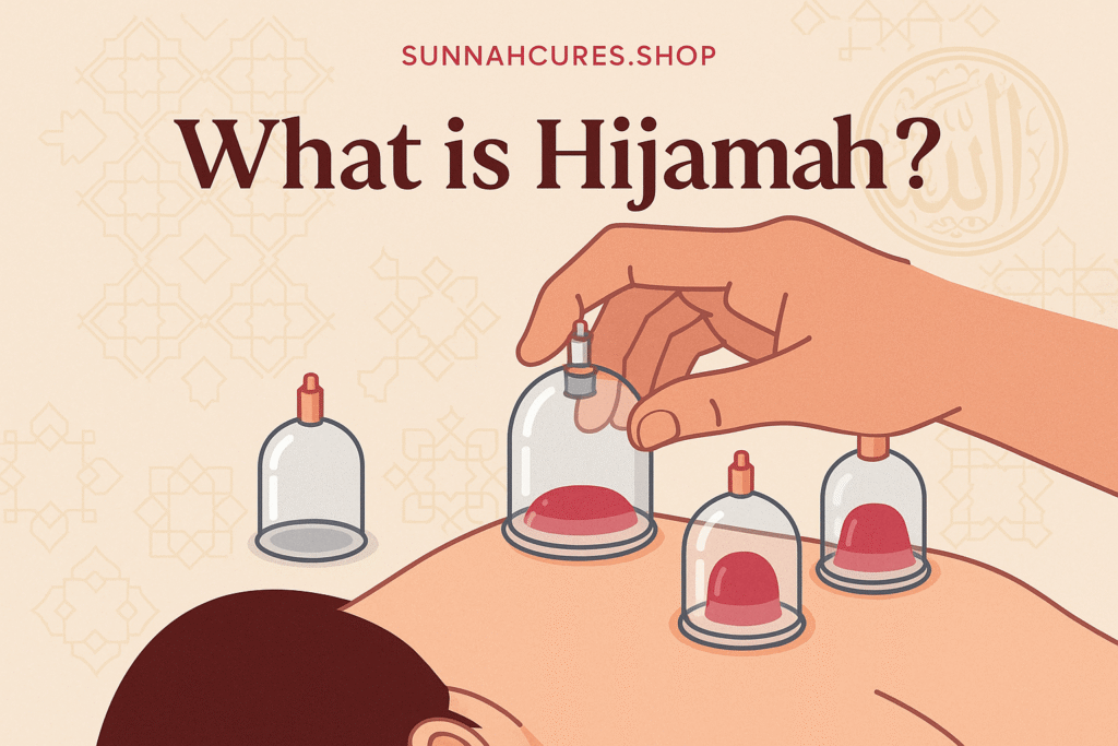 What is Hijamah? – A Sunnah-Based Healing Therapy